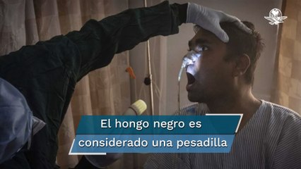 Esto es lo que sabemos sobre la rara infección por hongos que ataca a pacientes con Covid en India