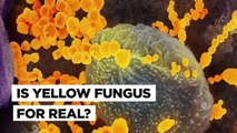 After Black And White, Yellow Fungus Is The New Covid-19 Complications Scare