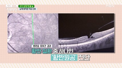 ◎눈에 찾아온 이상 신호◎