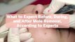 What to Expect Before, During, and After Mole Removal, According to Experts