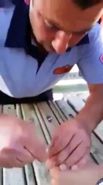 Comment retirer une bague coincée au doigt