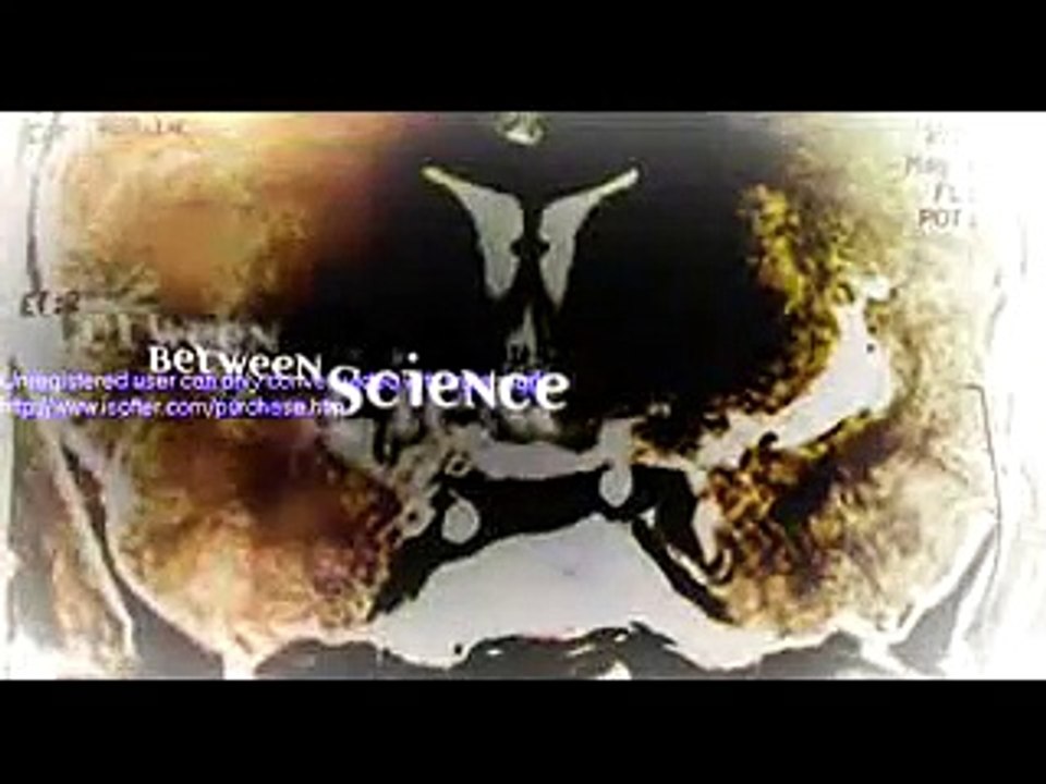 Infection (Trailer HD)
