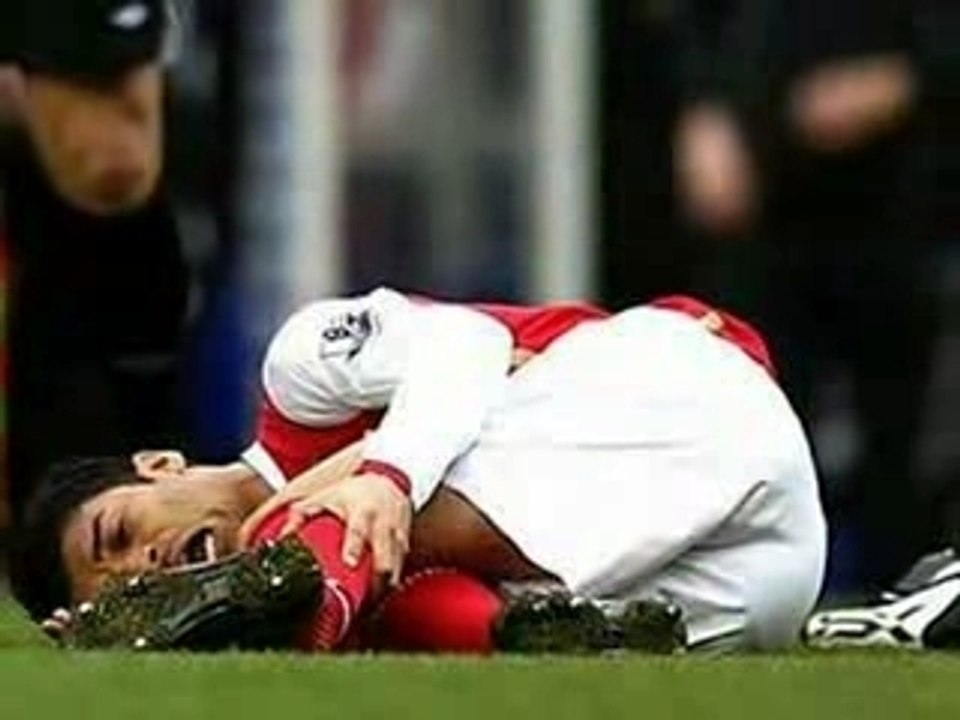 Da Silva broken leg