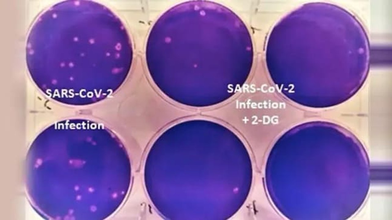 DRDO Covid drug | Price of 2DG anti-Covid drug fixed at Rs 990 per sachet