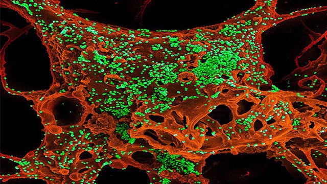 Coronavirus को क्या वाकई हराएगा Anti-Covid Nanobodies , Doctors Advice | Boldsky