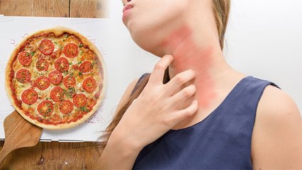 Oregano का ज्यादा इस्तेमाल हो सकता है बेहद खतरनाक | Oregano Side Effects | Boldsky