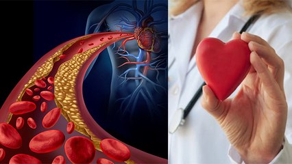 Blood में Lipid Level बढ़ने - घटने का मतलब क्या होता है ? | Blood Lipid Level | Boldsky
