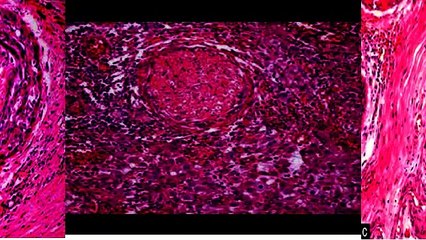 ERUPÇÃO DENTAL: MECANISMOS REVISTOS E REAVALIADOS