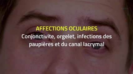 Homéopathie - Apis mellifica