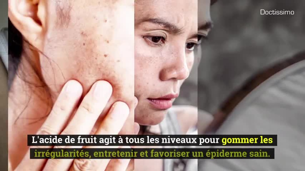 Ingrédients cosmétiques - L'acide glycolique