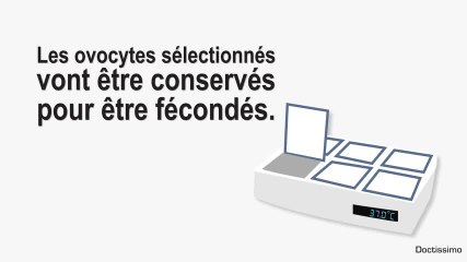 Les étapes d’une FIV avec ICSI