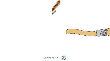 Comment se passe une perfusion