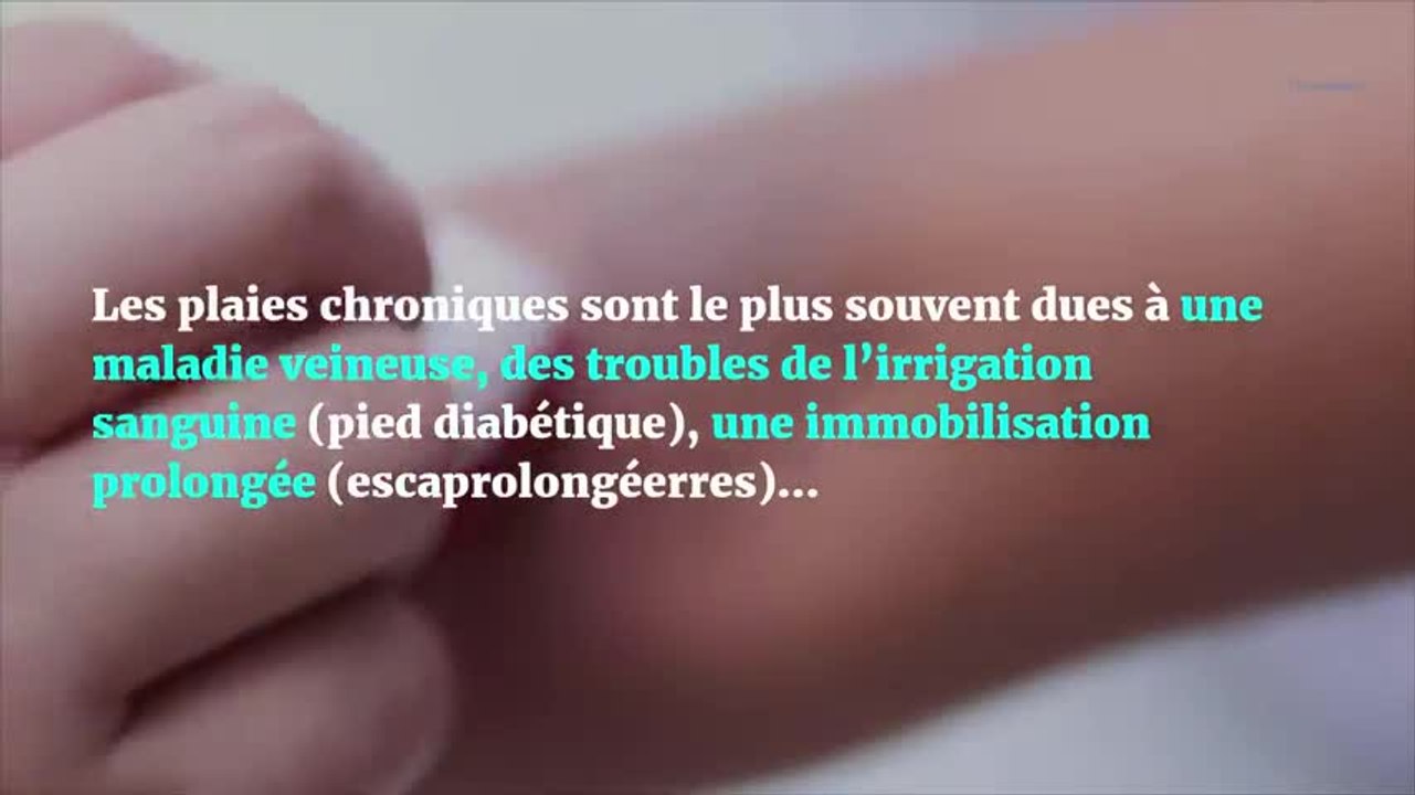 Un pansement intelligent pour soigner les plaies chroniques