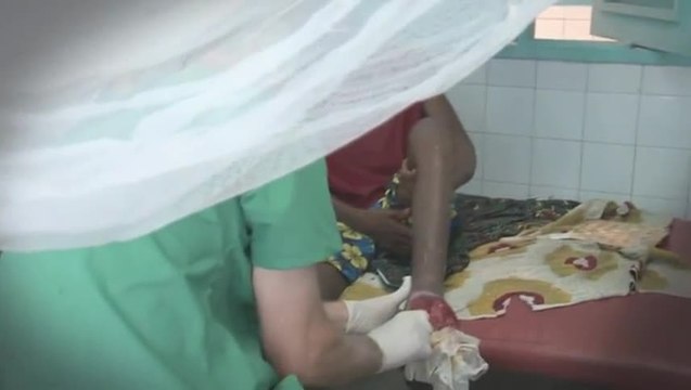Médecins Sans Frontières - Portrait de Bernard, chirurgien