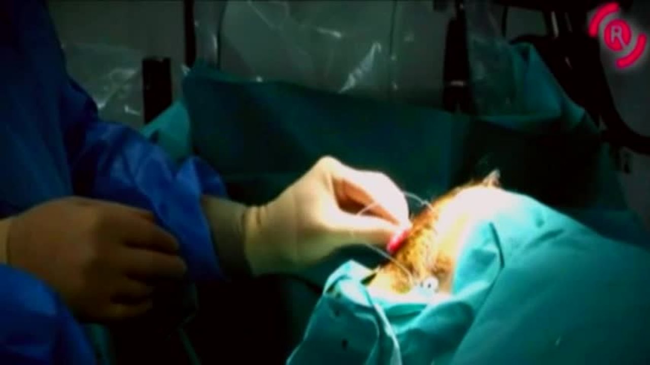 Chirurgie du cerveau : le robot Rosa prend la main… du neurochirurgien