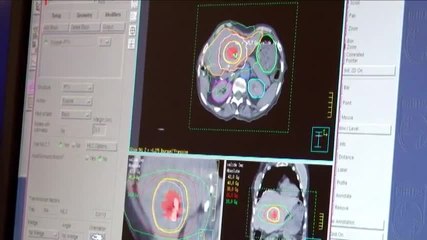 Radiothérapie du cancer : le rôle du physicien médical