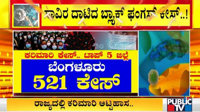 1250 Black Fungus Cases Have Been Reported From Karnataka In Total