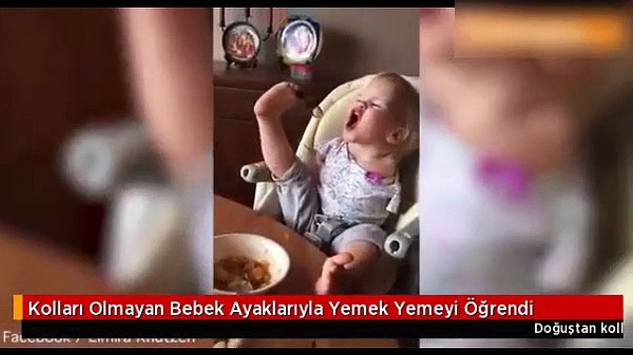 Kolları olmayan bebek ayaklarıyla yemek yemeyi öğrendi