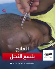 مدرس ليبي يدعي علاج جميع الأمراض بـ"لسع" النحل