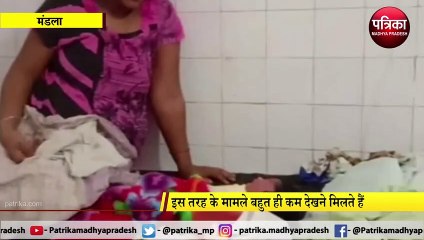 MANDLA: 5.1 किलो की बच्ची को दिया जन्म