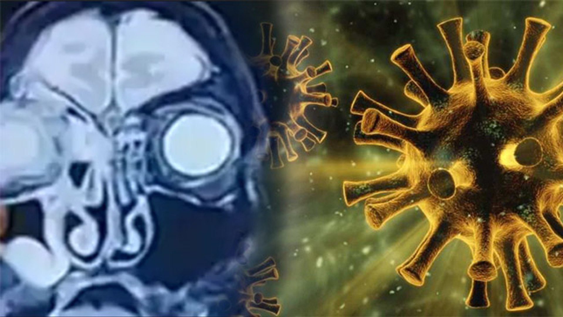 ⁣Black Fungus के दो नए Variants आए सामने, इस तरह से कर रहे हैं हमला | Boldsky