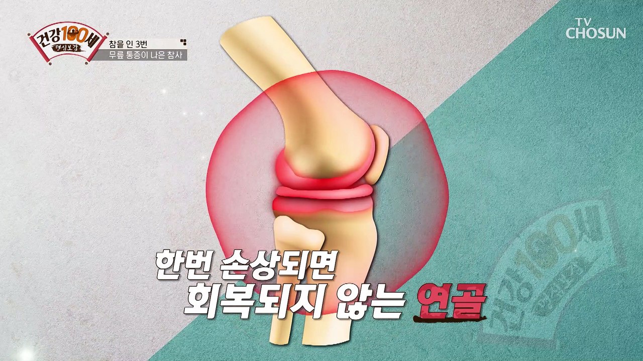 달걀로 알아보는 퇴행성 관절염 자가 진단↗ TV CHOSUN 210530 방송