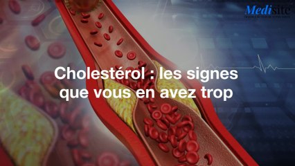 Cholestérol : les signes que vous en avez trop