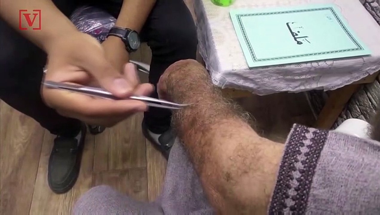 Man Uses Bee Stings to Help Relieve His Patients' Chronic Pain