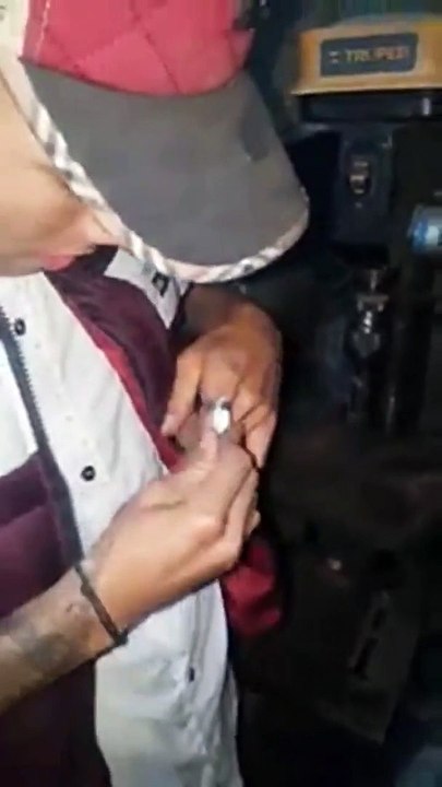 Il se fait retirer sa bague coincée au doigt d'une façon risquée