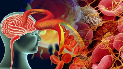 Blood Clotting के इन संकेतों को भूलकर भी न करें नजरअंदाज, हो सकता है खतरनाक । Boldsky