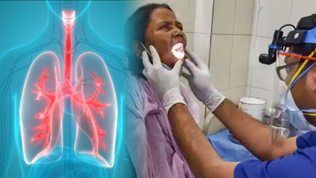 Black Fungus के 2 New Variants ने बढ़ाई चिंता, इन Body Parts को कर रहे हैं Damage | Boldsky