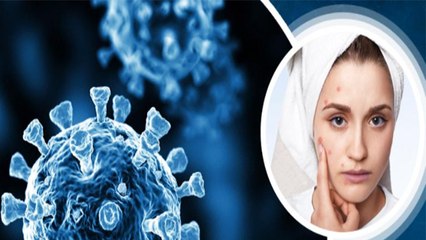 Post Covid Recovery के बाद बढ़ जाती है ये Skin Problems,जाने बचाव के Tips । Boldsky
