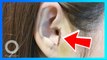 Wanita ‘kehilangan’ bagian telinganya selama operasi hidung - TomoNews
