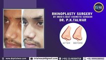 Affordable / Lowest Cost Rhinoplasty (Nose Job) in India, Delhi by Cosmetic Surgeon Dr PK Talwar