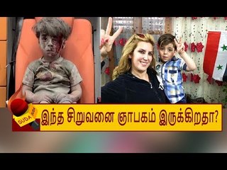 மரணத்தில் இருந்து தப்பிய சிரியாவின் 'ஓம்ரான்' எப்படி இருக்கிறான்?
