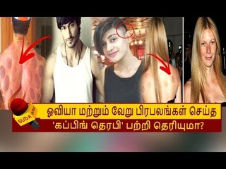 OVIYA செய்து கொண்டதாகச் சொல்லப்படும் 'CUPPING THERAPY' பற்றி தெரியுமா?  | ACTRESS OVIYA
