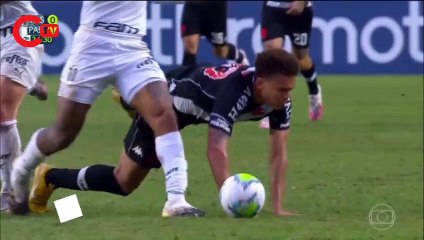 Felipe Melo'nun ayak bileği kırıldı