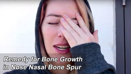 Remedy For Bone Growth In Nose | Nasal Bone Spur  | Health Tips