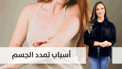 هذه هي أسباب تمدد الجسم