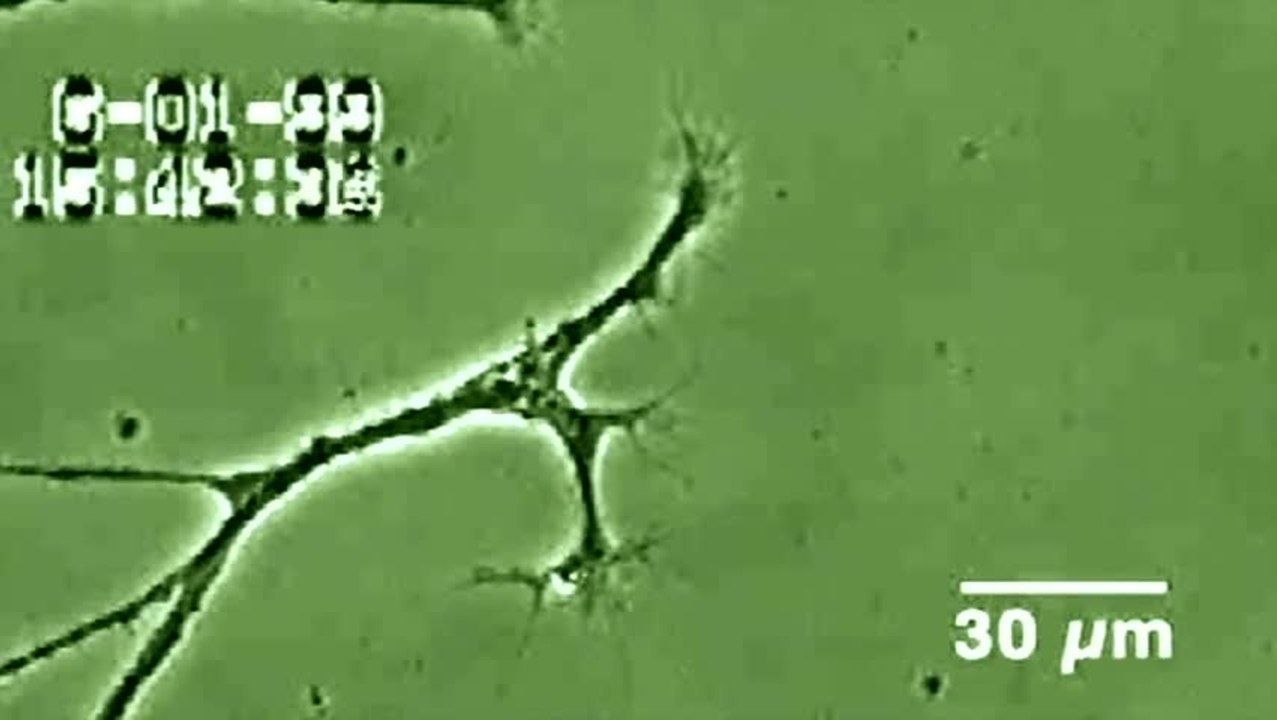 Bulb Fiction - Clip 4 Nervenzellen sterben (Deutsch)