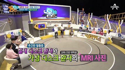 잘못된 자세가 병을 부른다?! 의자의 저주 '가성 디스크'