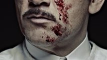 The Knick - S01 Trailer (English) HD