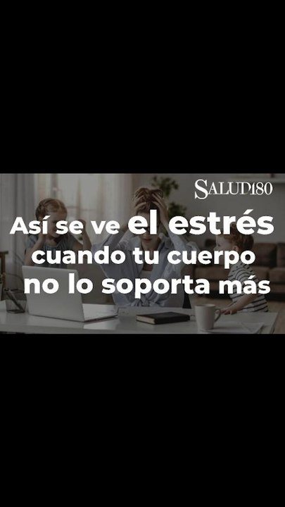 Así se ven los síntomas de estrés en tu cuerpo...