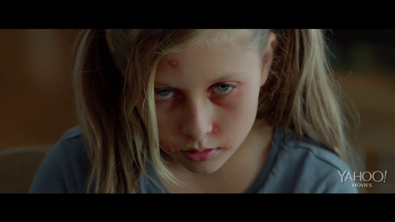 Cooties Video 1 von 5