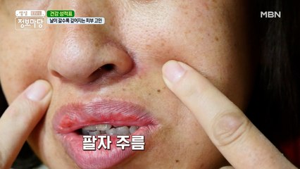깊어지는 팔자 주름 때문에 죽겠어요...( T д T)