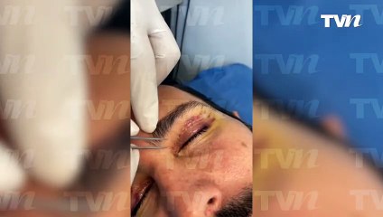 Le retiran los puntos de la cirugía a Poncho de Nigris