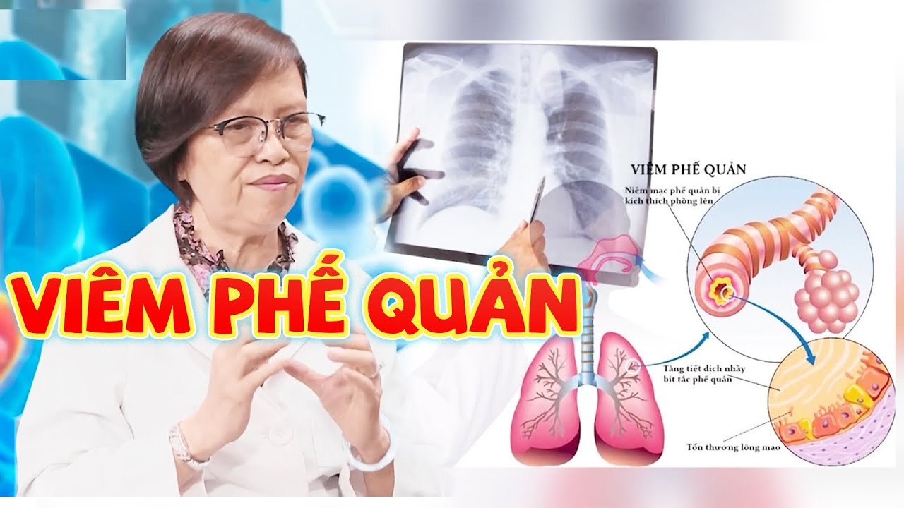 Bác sĩ nói gì #43 I Viêm phế quản mãn tính nguyên nhân và cách chữa trị