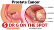 EP41: Things that you need to know about prostate | PUTTING DR G ON THE SPOT