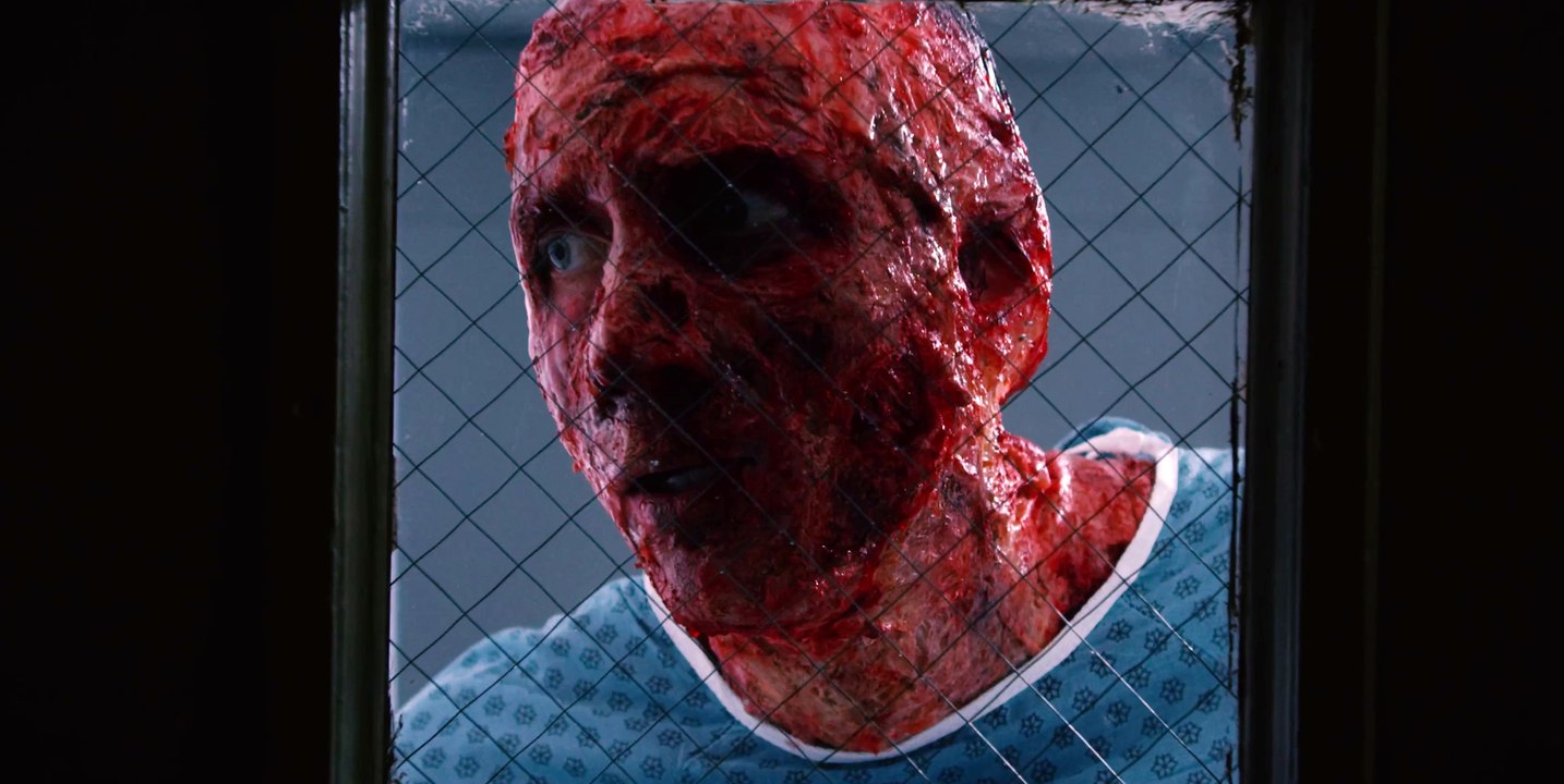 Inoperable - Trailer (English) HD