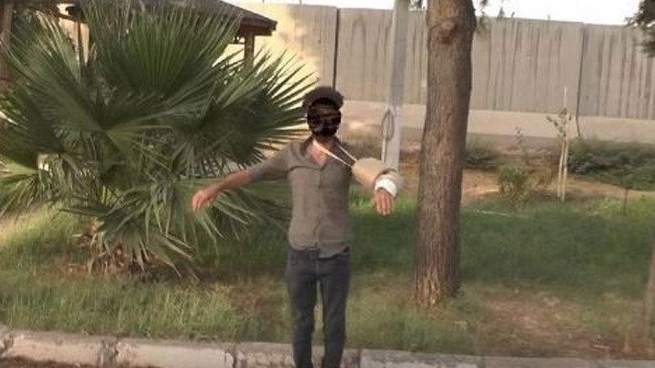 Yakalanan terörist bombayı kolundaki alçıya saklamış